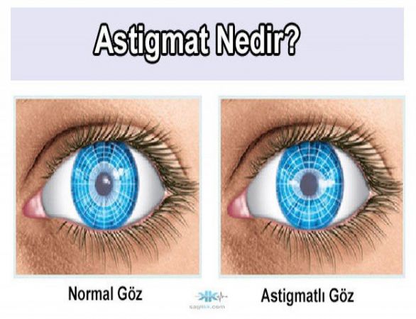 Astigmat Nasıl Görür