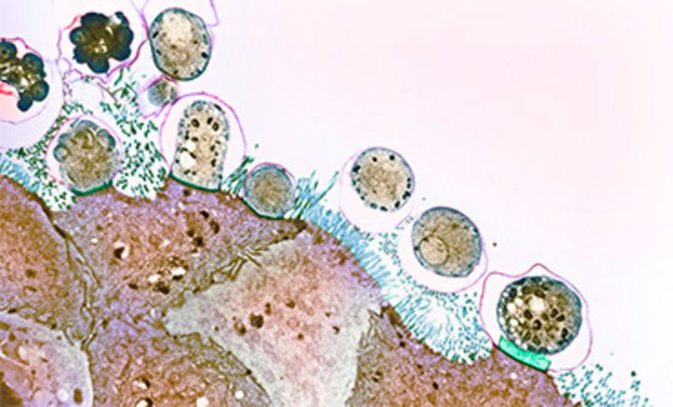 Cryptosporidiosis Hastalığı