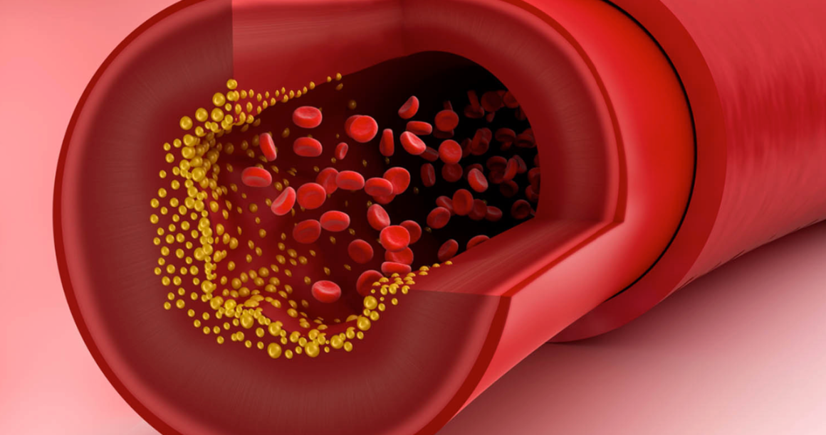 kolesterol-neden-yukselir-dusurmek-icin-neler-yapilabilir-32181