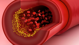 Kolesterol Neden Yükselir Düşürmek İçin Neler Yapılabilir