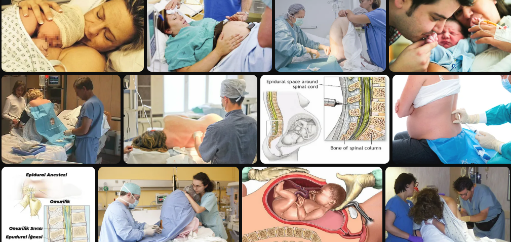 epidural-ile-normal-ve-sezaryen-dogum-yapan-annelerin-yorumlari-75896