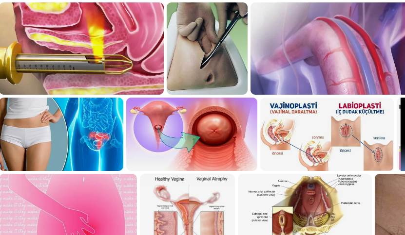 vajina-sismesinin-nedenleri-vajina-ic-dudaklari-neden-siser-69829